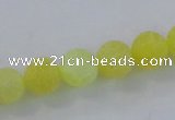 CAG7521 15.5 inches 10mm round frosted agate beads wholesale