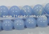 CTU1737 15.5 inches 16mm round synthetic turquoise beads