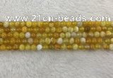 CAA1851 15.5 inches 6mm round banded agate gemstone beads