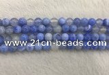 CAA2334 15.5 inches 10mm round banded agate gemstone beads