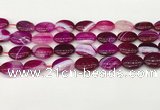 CAA4663 15.5 inches 13*18mm oval banded agate beads wholesale