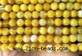CAA6311 15 inches 8mm faceted round yellow banded agate beads