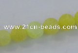 CAG7518 15.5 inches 4mm round frosted agate beads wholesale