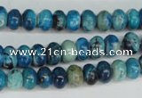 CCO170 15.5 inches 5*8mm rondelle dyed natural chrysotine beads