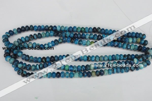 CCO170 15.5 inches 5*8mm rondelle dyed natural chrysotine beads