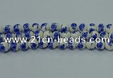 CPB542 15.5 inches 8mm round Painted porcelain beads