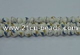 CPB595 15.5 inches 14mm round Painted porcelain beads