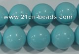 CTU1217 15.5 inches 18mm round synthetic turquoise beads