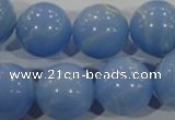 CTU1739 15.5 inches 20mm round synthetic turquoise beads